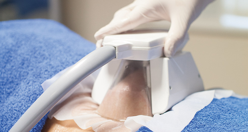 Multiple Areas in One Session HIFU and Fat Freezing Sunbury-on-Thames