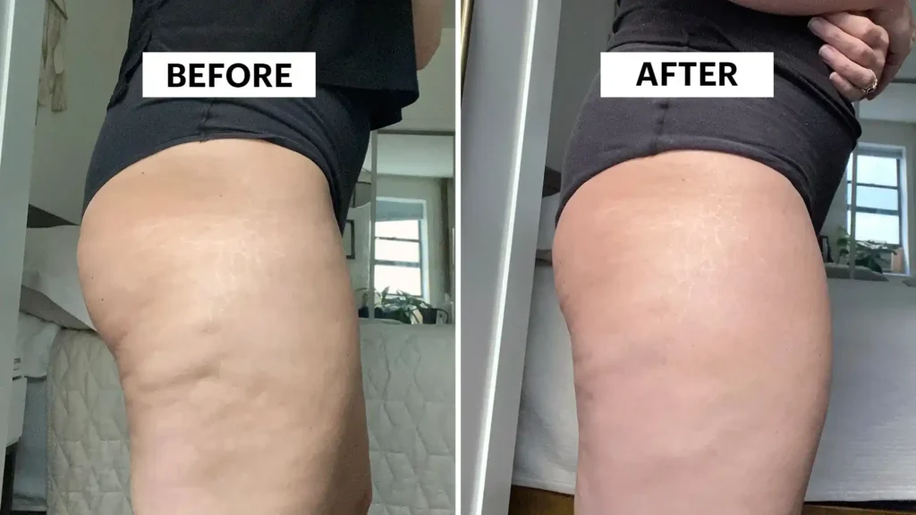 Do Toning Exercise Sunbury-on-Thames Really Tackle Cellulite?