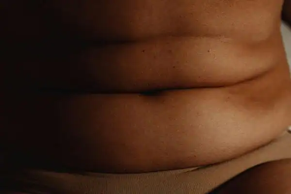 The Hidden Connection: How Stress Shapes Your Fitness and Body Composition 3 image of what stress can do on the stomach area and how Lipo 360 Sunbury-on-Thames can help to change your body shape.