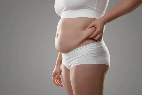 Image of stress belly Sunbury-on-Thames How Lipo 360 can help manage your symptoms
